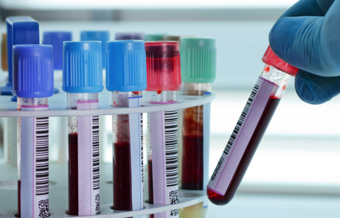 Le suivi médical du haut niveau, un outil de santé, pas d’anti-dopage